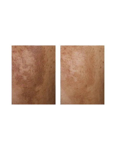 Eucerin Anti Pigment Creme Noite 50ML